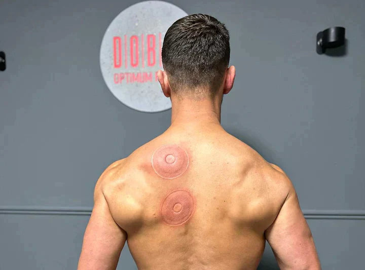 RecoverCup™ SmartCupping Massager