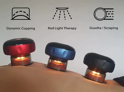 RecoverCup™ SmartCupping Massager